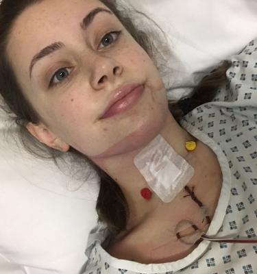 Natalie after thyroid surgery