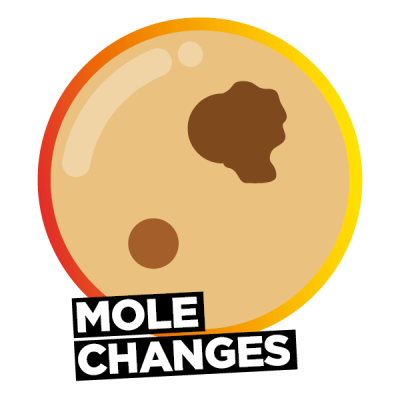 Mole changes