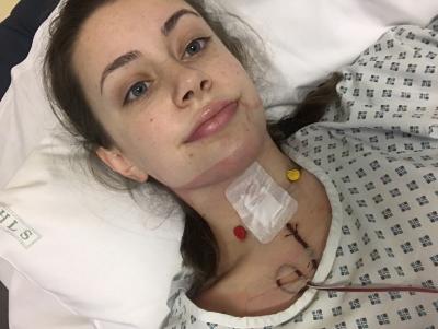 Natalie after thyroid surgery