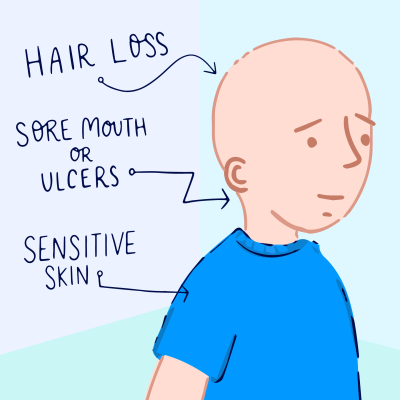 Side Effects of Chemotherapy - Hair loss, sore mouth or ulcers and sensitive skin