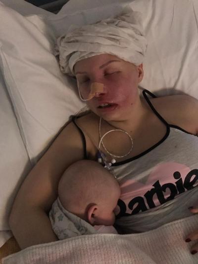 Poppy with Bella during treatment
