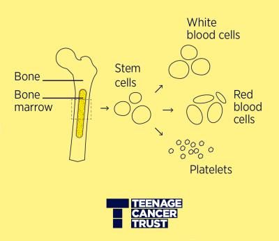 Image shows the process of bone marrow creating stem cells which in turn develop into white blood cells, red blood cells and platelets