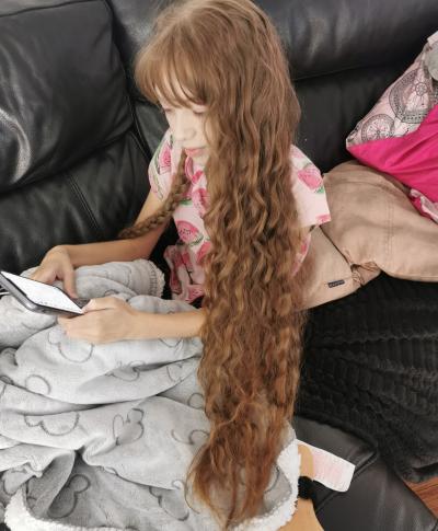 Billie before her treatment