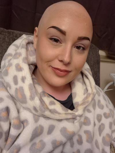 A young woman with a bald head and great eyebrows smiles at the camera. She is wearing a grey leopard print fleecy top with a hood. 