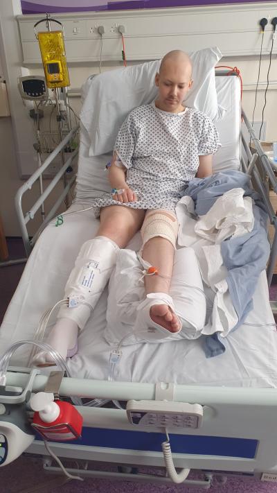 A man who has lost his hair sits in a hospital bed with a hospital gown on and a cast on his left leg